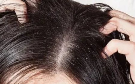 Kaşınan saç derisine 20 dakikada doğal çözüm!