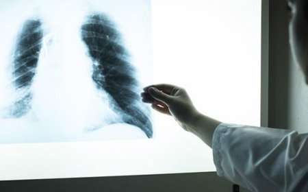 Hiç sigara içmeyenler arasında akciğer kanseri teşhisleri artıyor