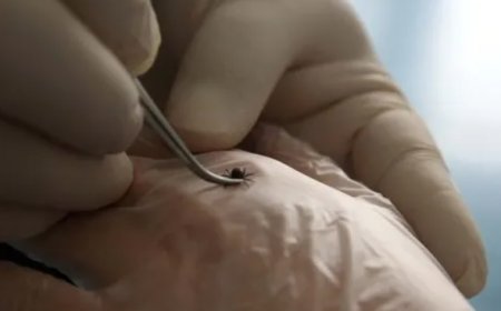 Yaz Aylarında Kene Riskine Dikkat: Uzmanlar Uyarıyor