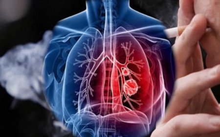 Akciğer Kanseri Vakalarının %20’si Sigara Kullanmayanlarda Görülüyor