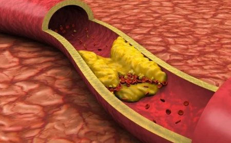 Yüksek kolesterolün vücuttaki gizli belirtileri neler?