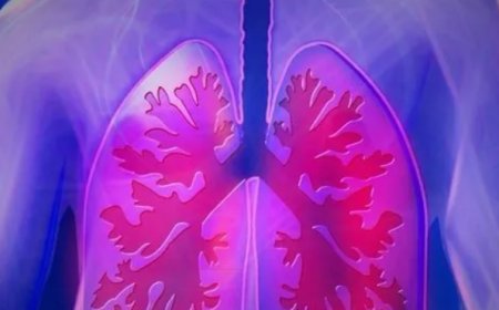 Akciğer Kanserinde İlk Aşama Hayati: Erken Tanı Başarıyı Katlıyor