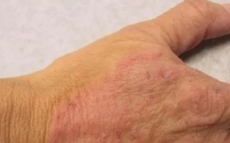 Sıcak ve nem mantar vakalarını artırıyor.