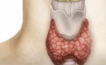 DİKKAT! Uzmanından Önemli Uyarı: "Tiroit Bozuklukları Enerji Dengesi İçin Tehlike"