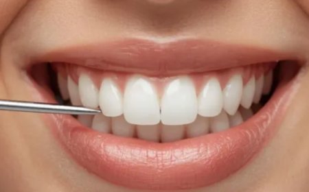 Sosyal Medya Akımlarına Kanmayın! Kontrolsüz Diş Beyazlatma Kalıcı Hasar Bırakıyor