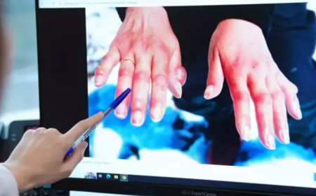 Kış Kapıda, Tehlike Kapıda: Soğuk Isırığına Karşı Uzmanlardan Hayati Uyarılar