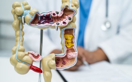 Uzmanından Kritik Detoks Uyarısı: Şişkinliği Gidereyim Derken Sağlığınızdan Olmayın!