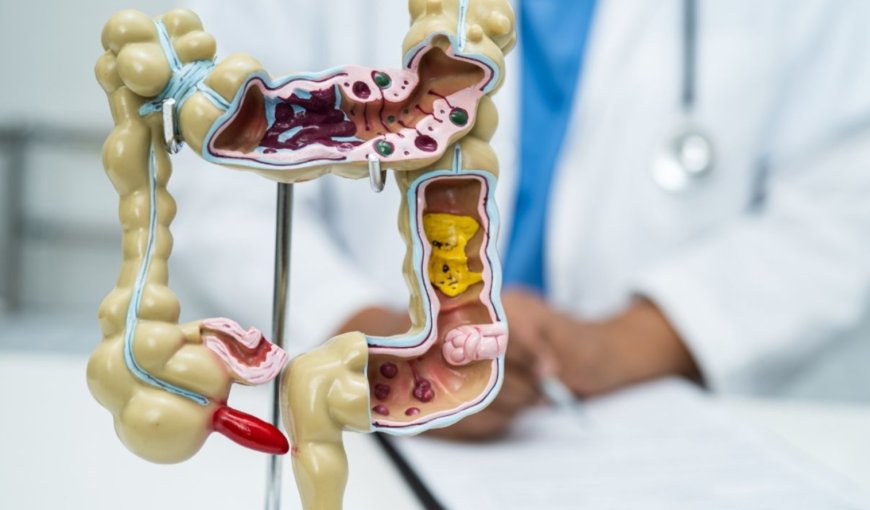 Uzmanından Kritik Detoks Uyarısı: Şişkinliği Gidereyim Derken Sağlığınızdan Olmayın!