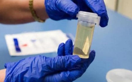 İşe Alımlarda Yeni Şart: Uyuşturucu Testi Dönemi Başlıyor