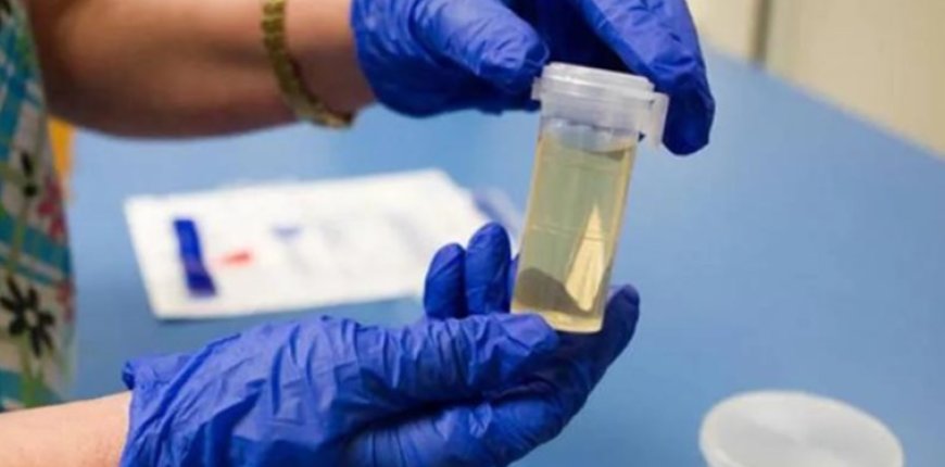 İşe Alımlarda Yeni Şart: Uyuşturucu Testi Dönemi Başlıyor