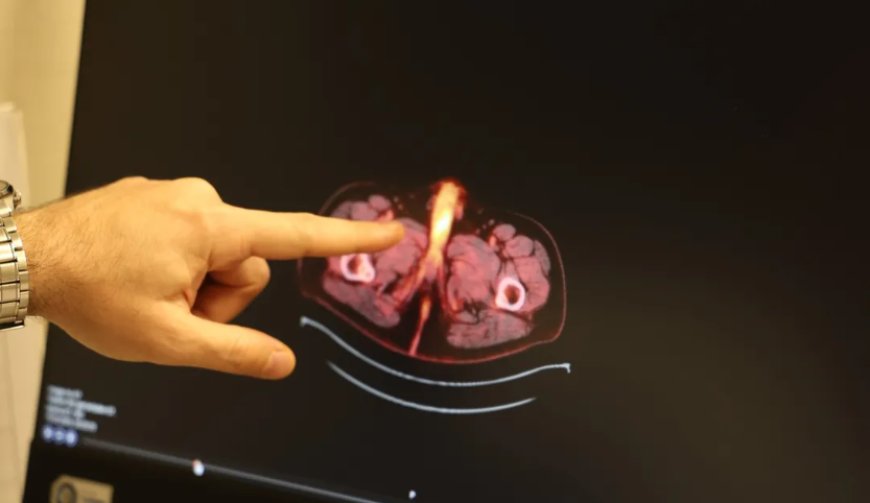 Diyarbakır'da Tıp Dünyasını Şaşırtan Teşhis: Dünyanın 61. Vakası mı?