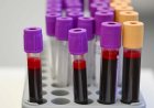 Kan Grubunuz Felç Riskinizi Belirliyor mu? İşte Tıp Dünyasını Şaşırtan O Araştırma.