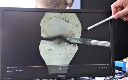 Uzmanından Eklem Kireçlenmesi Uyarısı ve Öne Çıkan Tedavi Protokolü