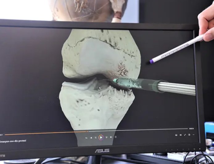 Uzmanından Eklem Kireçlenmesi Uyarısı ve Öne Çıkan Tedavi Protokolü